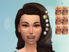 Sims 4 braces
