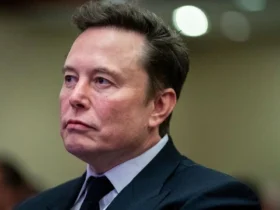 Why is elon musk so lumpy and ugly